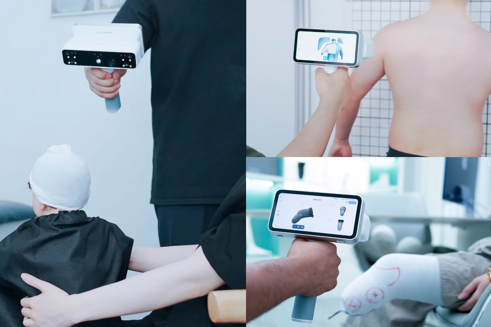 Shining 3D EinScan Medixa